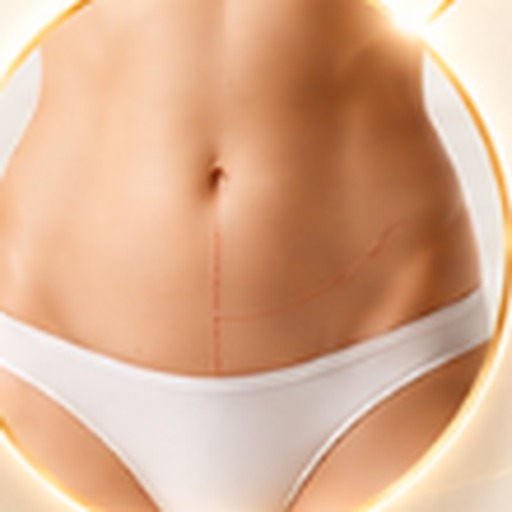 Revision liposuction