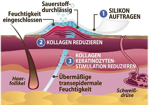 Regolazione del collagene